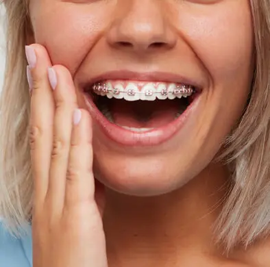 Same Day Braces Dr. Bret Johnson Orthodontics