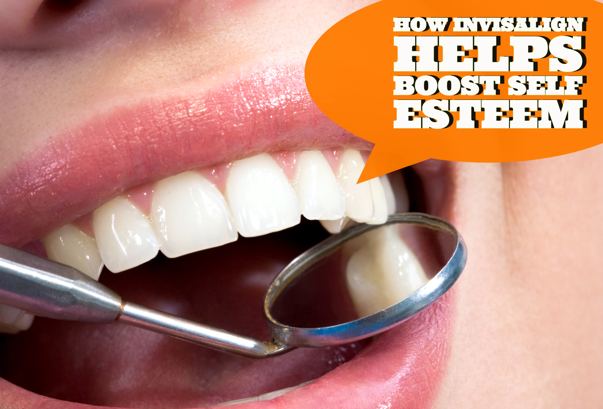 HOW INVISALIGN HELPS BOOST SELF ESTEEM