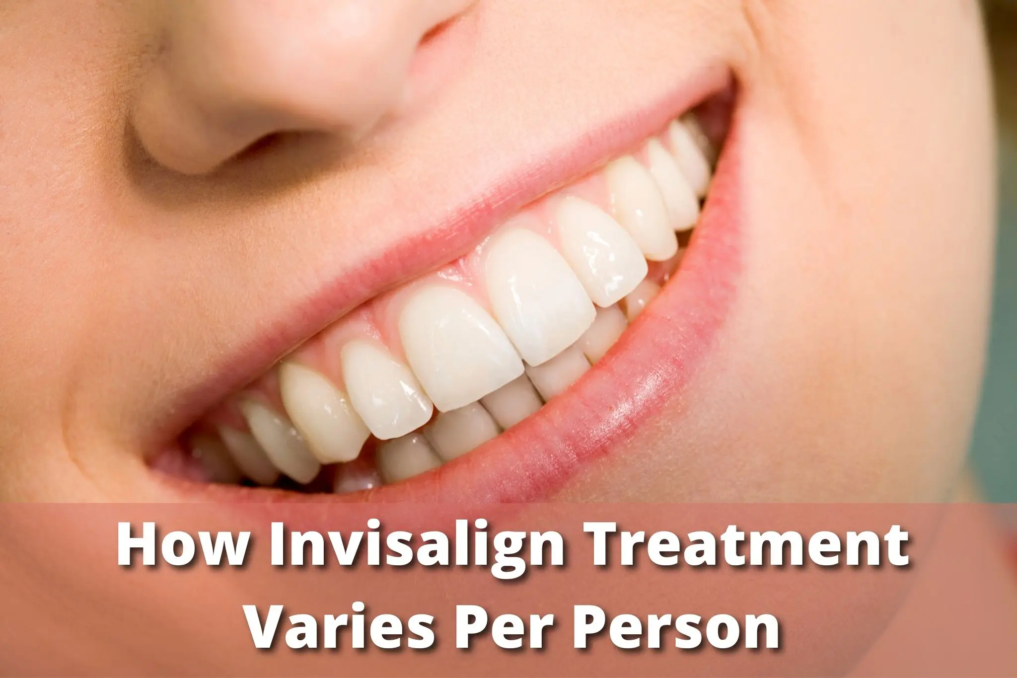 How Invisalign Treatment Varies Per Person