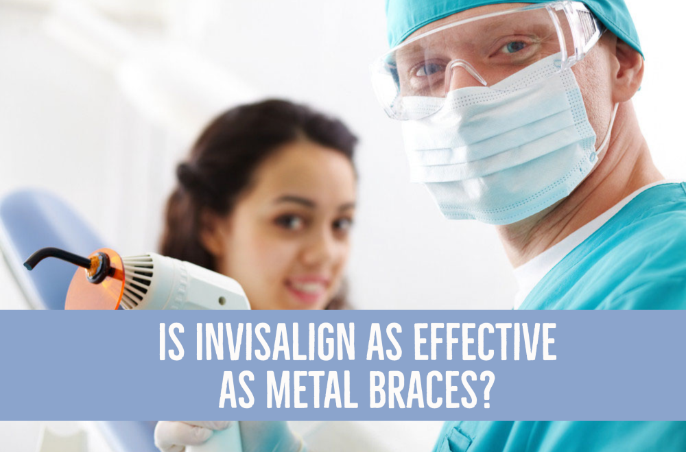 clear aligner treatment