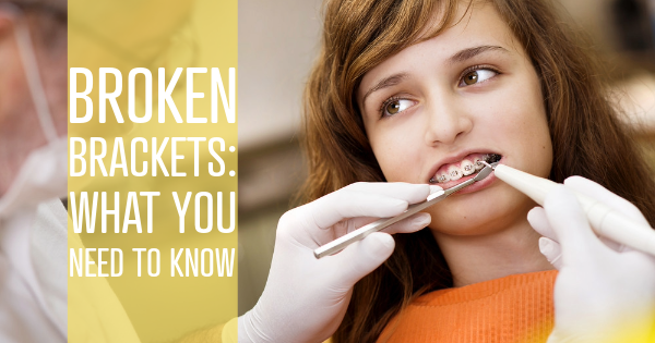 orthodontic treatment