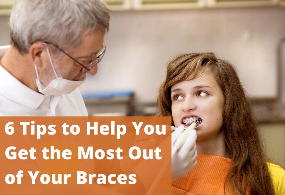 6 Tips to Help You Get the Most Out of Your Braces