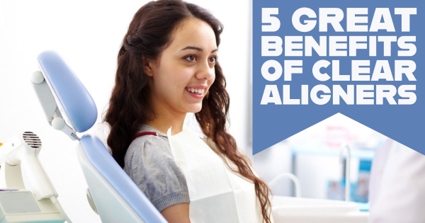 5 Great Benefits of Clear Aligners