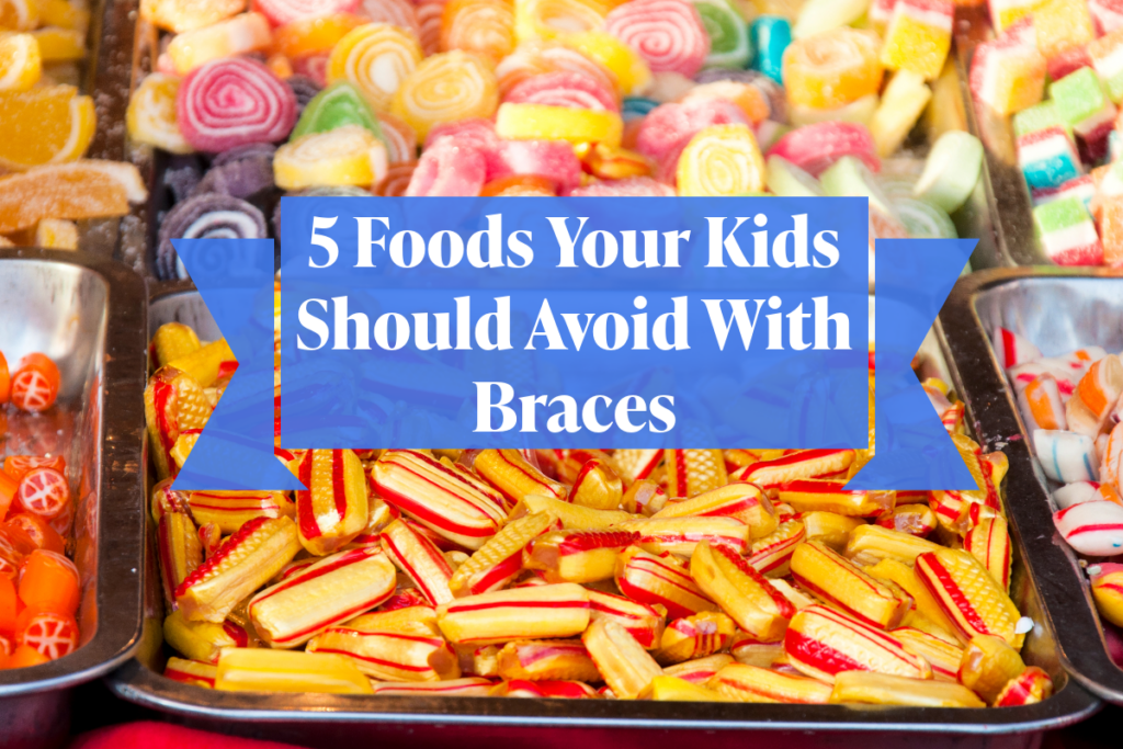 5 Foods Your Kids Should Avoid With Braces